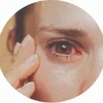 Cow’s milk : ଶୁଷ୍କ ଆଖି ସମସ୍ୟା ଦୂରକରେ ଗାଈ କ୍ଷୀର!