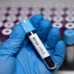 Mpox Virus: ମଙ୍କିପକ୍ସ ଭାଇରସ୍ ଶିଶି ଚୋରି କରି ଆତଙ୍କ ସୃଷ୍ଟି କଲେ ୨ ଆମେରିକୀୟ ବୈଜ୍ଞାନିକ